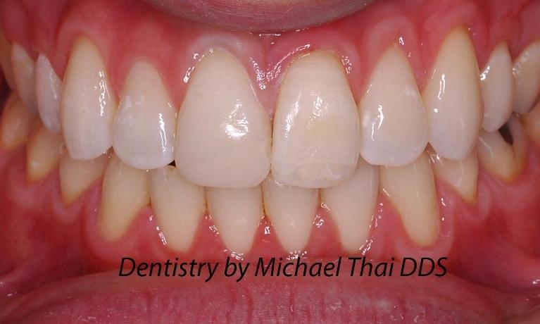 Composite-After-Image